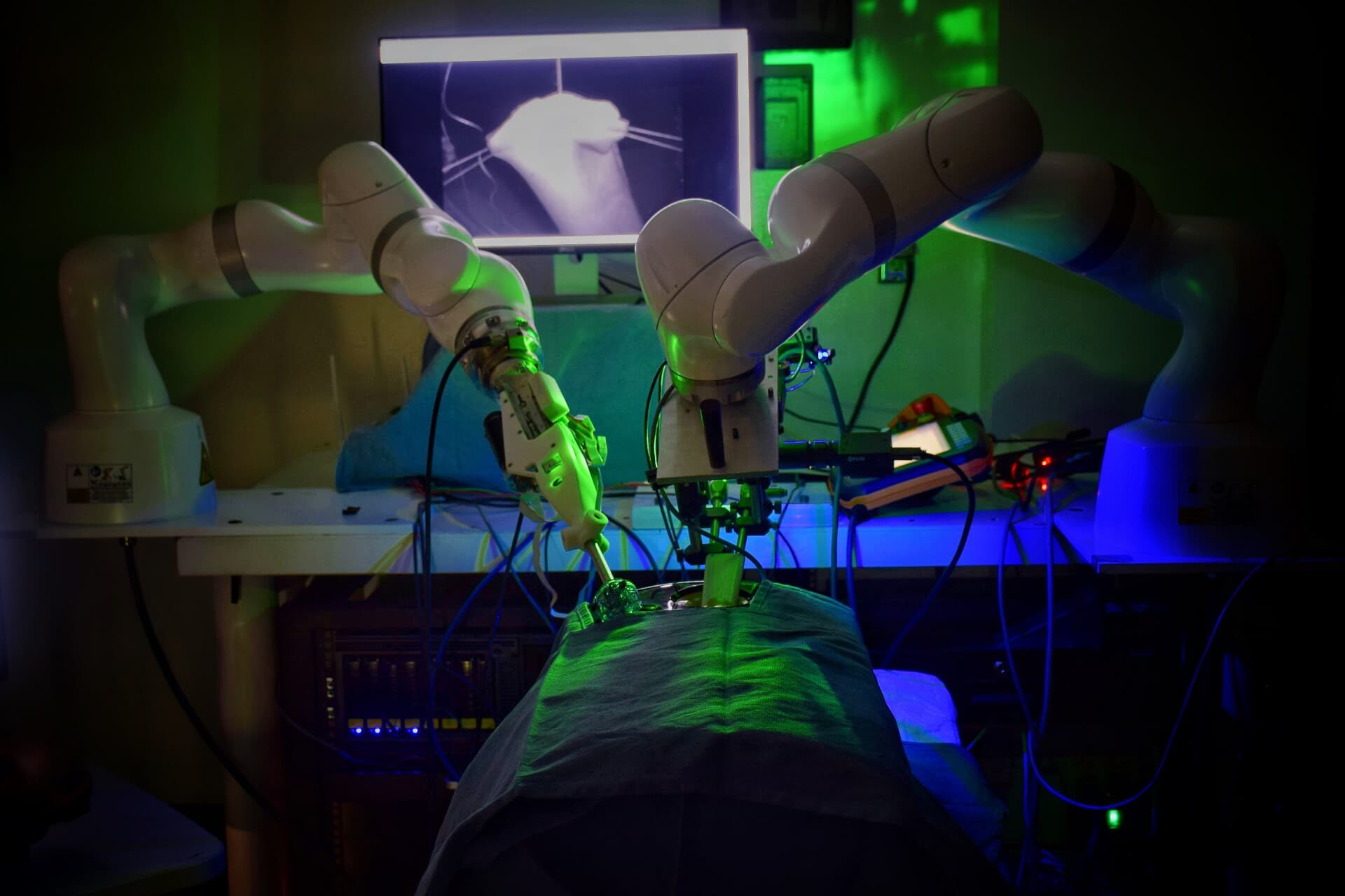 Biodegradable Balloon Spacer Surgery on 72-Year Old Marks Milestone for Minimally Invasive Orthopedics