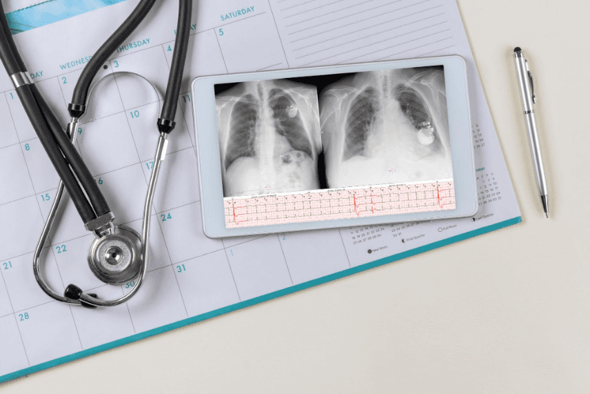 FDA Class I Recall: Boston Scientific ACCOLADE Pacemakers and CRT-P Devices Face Safety Mode Failure Risks