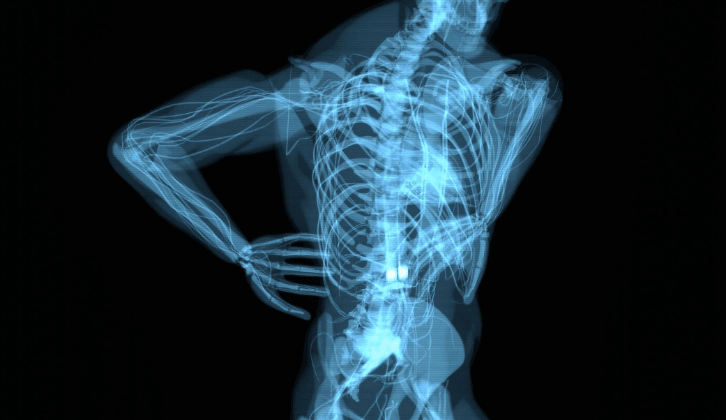 Medtronic’s Stealth AXiS Surgical System Named to TIME’s Best Inventions of 2026