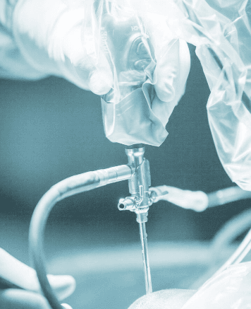 Image FDA Early Alert on Cook Medical Sizing Catheters Raises Risk of Device Breakage in Vascular Procedures Image 4